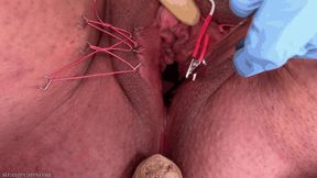electrified video: four holes painfully used (720 wmv)