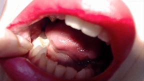 vampire video: Extremely ragged teeth