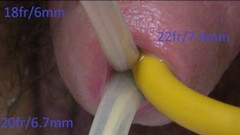 catheter video: Three catheters one pee hole
