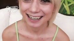 braces video: 19 Year Old with braces slobbers all over a fat cock