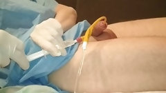 catheter video: Removal catheter