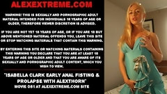 anal dilation video: Isabella Clark – early anal fisting & prolapse with AlexThorn