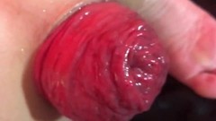 anal dilation video: Huge anal prolapse ruined very closeup
