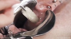 peehole video: Lesben Peehole Insertion