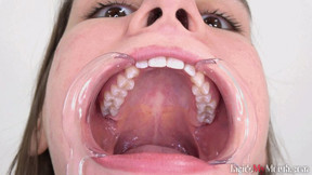 dentist video: Inside My Mouth - Hellen (4K)
