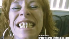 freckled video: Donkey Teeth Red Head mom Crack Slut