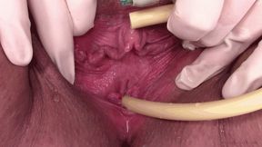 peehole video: catheter and surgical gloves (720 wmv)