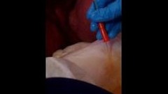 catheter video: bbw vaginal catheterization