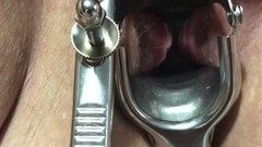 speculum video: Opening the wife