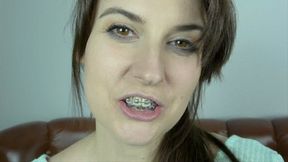braces video: Weronika - Before And With Braces - UHD 3840x2160 - 4K