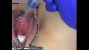 catheter video: Catheter