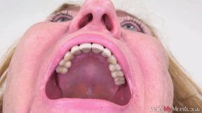 dentist video: Inside My Mouth - Zuzana (HD)