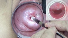 japanese extreme video: Mature Wife Cervix Playing with Endoscope Japanese Cam into Uterus